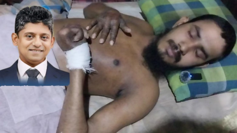 অসহায় মহসিনের চিকিৎসায় এগিয়ে এলেন আবুল কাউসার আশা